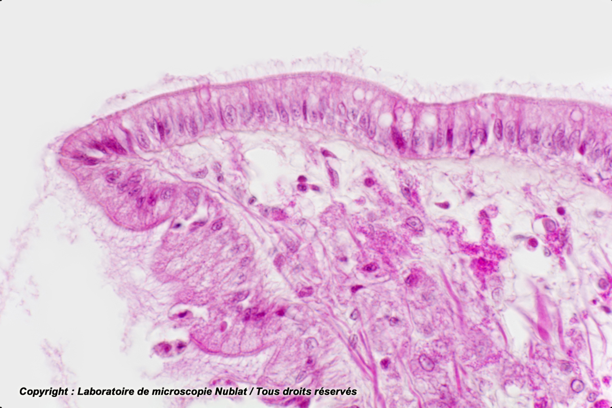 Epithélium cilié de Moule, HE